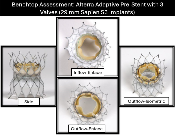 Alterra and SAPIEN Frame Overexpansion for Repeated Valve-in